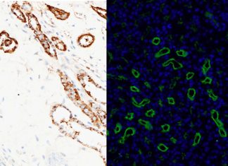 Cells missing a certain protein on their surface can’t move normally