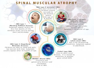 Approved the world most expensive gene therapy – $2M medicine – that treats an inherited condition called spinal muscular atrophy