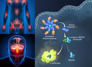 Researchers discover a way to stop inflammation with new anti-inflammasome drugs