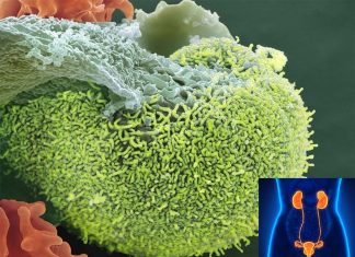 UTIs are one of the most common menopause bacterial infections in women