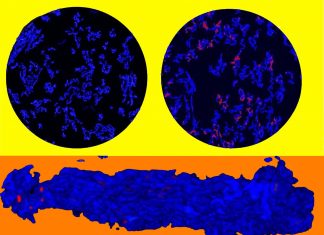 Orally administered vaccine can protect millions from hepatitis B