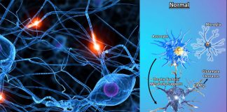Astrocytes feed neurons’ off-loaded damaged lipids to their own mitochondria, converting waste into energy