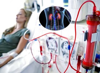 Dialysis : rapid liquid removing in kidney failure linked to increased death risk