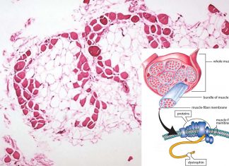 Tiny protein could play a major role in combating heart failure related to Duchenne muscular dystrophy (DMD)