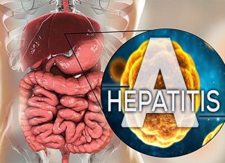 Mutations in the IL18BP gene causes the body’s immune system to attack and kill healthy liver cells