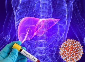 Hepatitis C virus hides in the immune system increasing the expression of SOCS