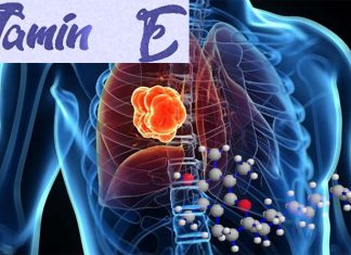 Lung cancer : Vitamin E can increase the cancer’s ability to spread