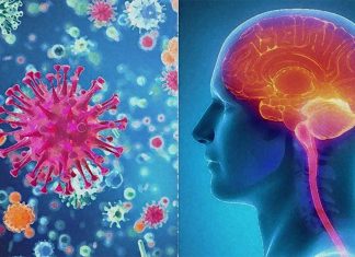 Exposure to viral infections in the brain during childhood has been linked to an increased risk of developing multiple sclerosis later in life