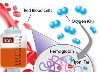 People with high iron levels are less likely to have high cholesterol