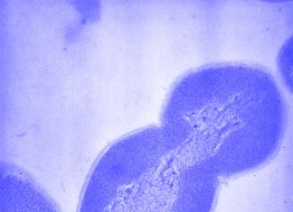 Crohn’s disease – Researchers have found that Ruminococcus gnavus bacterium triggers an immune response