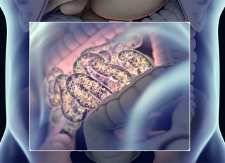 Small intestine bacterial overgrowth (SIBO) may be more prevalent among patients with restless legs syndrome (RLS)