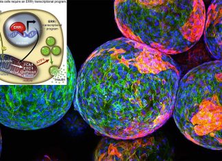 The benefit of Type 2 diabetes treatment – for beta cells – wane after stop in adults