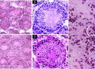 Researchers have discovered how Toxoplasma gondii – a dangerous parasite – maintains a steady supply of nutrients