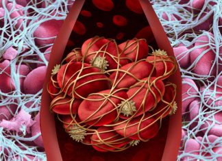 A common gut bacterium can trigger antiphospholipid syndrome