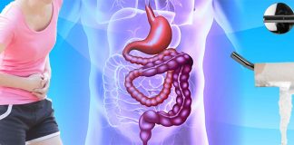 Researchers evidence that many athletes may have undiagnosed irritable bowel syndrome