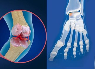Researchers have found that extremely common conditions are often never included in cartilage regeneration clinical trials – why ?
