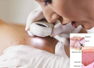 Researchers founds a way to diagnose skin cancer using shortwave rays