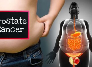 Higher levels of abdominal and thigh fat are associated with an increased risk of aggressive prostate cancer