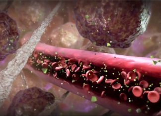 Researchers targets a molecule called hyaluronan (HA) to treat liver disease