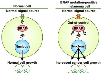 New therapy for advanced melanoma – BRAF V600E