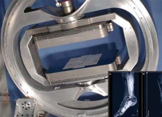 Researchers have developed a prototype mini MRI scanner that fits around a patient’s leg