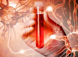 Researchers have developed a method to create a new blood marker capable of detecting whether or not a person has Alzheimer’s disease
