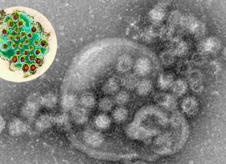 New discovery on Norovirus – can form small, medium and large structures depending on the viral strain