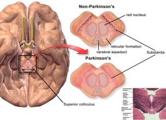 Fine motor tasks promote plastic reorganization of brain