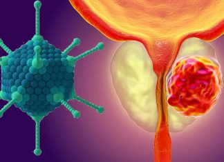Researchers have used a genetically manipulated virus to destroy prostate cancer