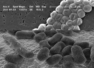 The survival of the bacteria is affect by temperature and the surface