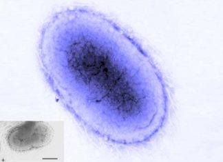 Akkermansia bacteria reduce cardiovascular risks