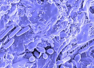 Researchers have uncovered an immune mechanism by which host cells combat bacterial infection