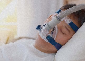 CPAP treatment of obstructive sleep apnea (OSA) can improve depression symptoms