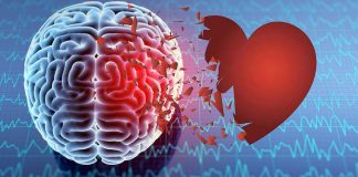 During a cardiac arrest there are two stages of brain injury