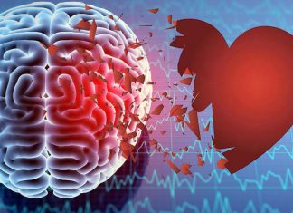 During a cardiac arrest there are two stages of brain injury