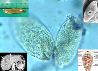 WHO : Fascioliasis included it in the list of the great diseases of humanity