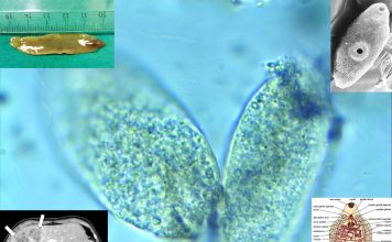 WHO : Fascioliasis included it in the list of the great diseases of humanity