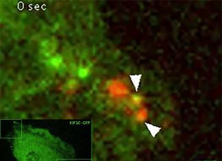 KIF1C: a tiny protein-based molecular motor which is necessary for maintaining proper neurological function