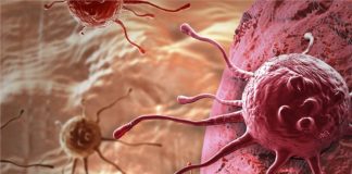 Researchers discovered why inactive LKB1 results in cancer development