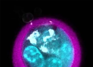 Researchers demonstrate a single-cell encapsulation technology that protects transplanted MSCs from immune attack