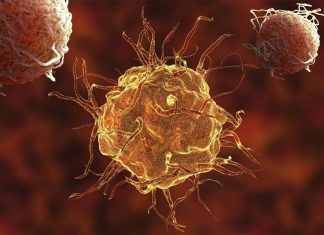 Macrophages reducing inflammation when they engulf cellular debris or foreign microbes that contribute to inflammation