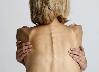Anorexia include both metabolic and psychiatric components