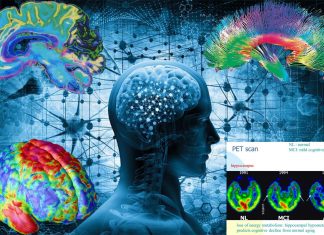 Functional regions within the brain become less distinct and interconnected in the elderly over time