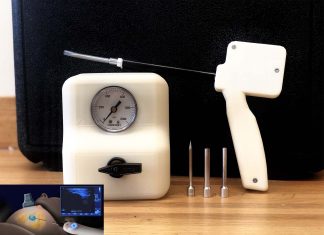 A new reusable device can help women with breast cancer in lower income countries by using carbon dioxide