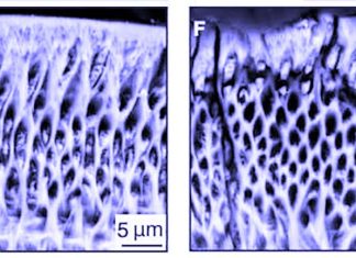 Scientists have shown how a tiny flaw in a protein results in damaged enamel that is prone to decay