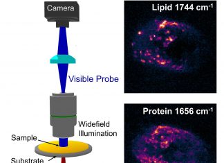 New infrared chemical imaging allow the detection of aggressive breast – prostate and other cancers