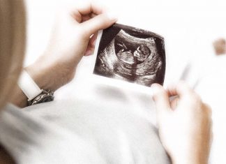 With every week that a pregnancy continues past term (37 weeks) the risk of stillbirth increases