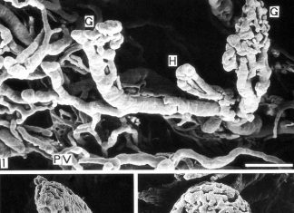 Blood vessels within bone marrow may progressively convert into bone with advancing age