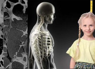 Children who mature later may be at increased risk of the fragile bone condition osteoporosis in later life