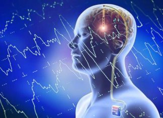 Deep brain stimulation reduce tremors and muscle rigidity that are the hallmark of Parkinson’s disease